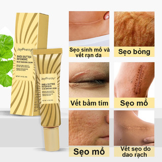 Kem mờ sẹo Gentacin 40g mờ thâm mụn mờ sẹo lồi sẹo lõm sẹo rỗ ngừa mụn rạn da giảm thâm mắt