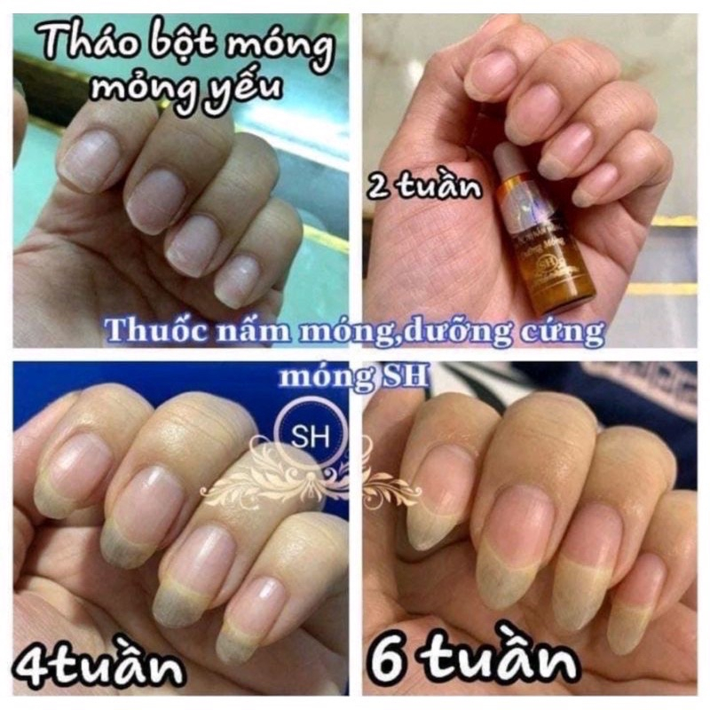 Combo Sỉ 50 Serum Nấm Móng Đánh Bay Bọng Móng Hư Khóe Nấm Móng Nước Ăn Tay Chân