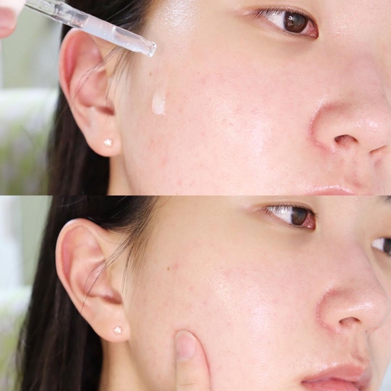 Tinh chất diệt mụn ISOI ACNI Dr. 1st Speedy Spot