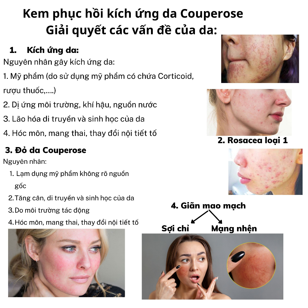 Kem Phục Hồi Kích Ứng Da Couperose Swissforce