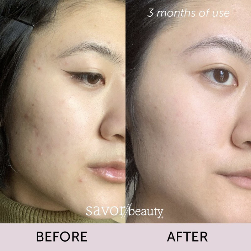 🇺🇸 Sữa rửa mặt làm sạch sâu kháng mụn The INKEY List Salicylic Acid Cleanser 150ml