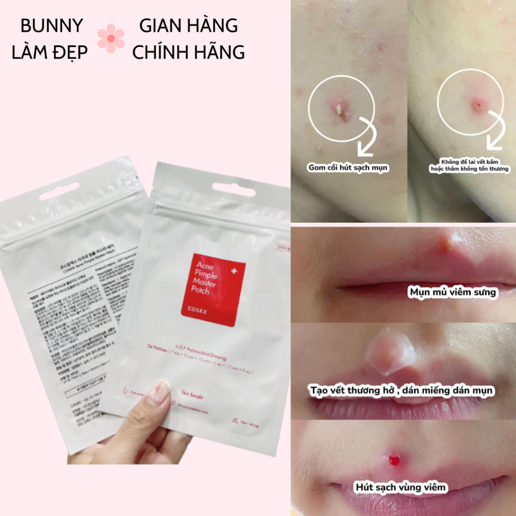 Miếng Dán Mụn Cosrx Acne Pimple Master Patch