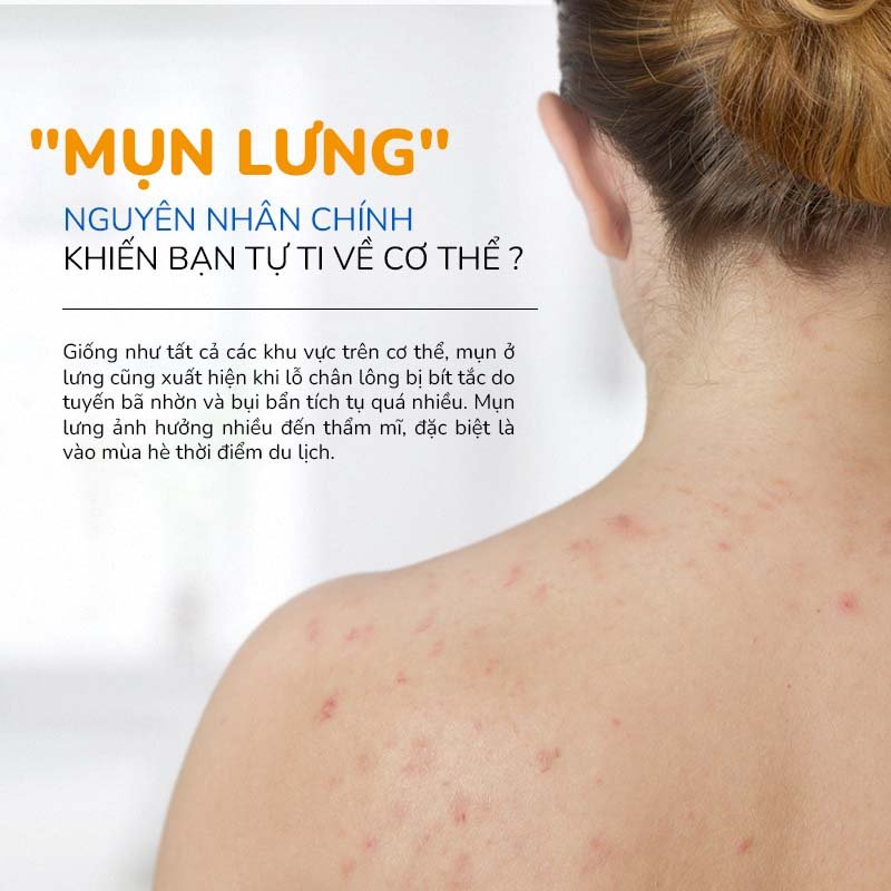 Xà Phòng Giảm Mụn Lưng Thiên Nhiên, Giảm Thâm Mông Tặng Kèm Túi Lưới NEOSKIN 75gr