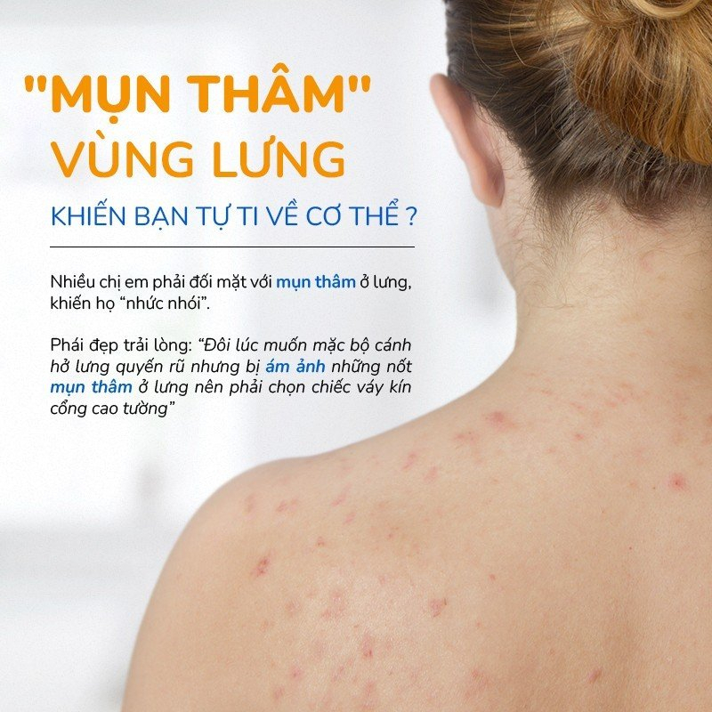 Xà Phòng Tắm Rau Má & Cúc La Mã Làm Dịu Mụn Lưng, An Toàn, Thiên Nhiên 100% Phù Hợp Với Da Body Nhạy Cảm NEOSKIN