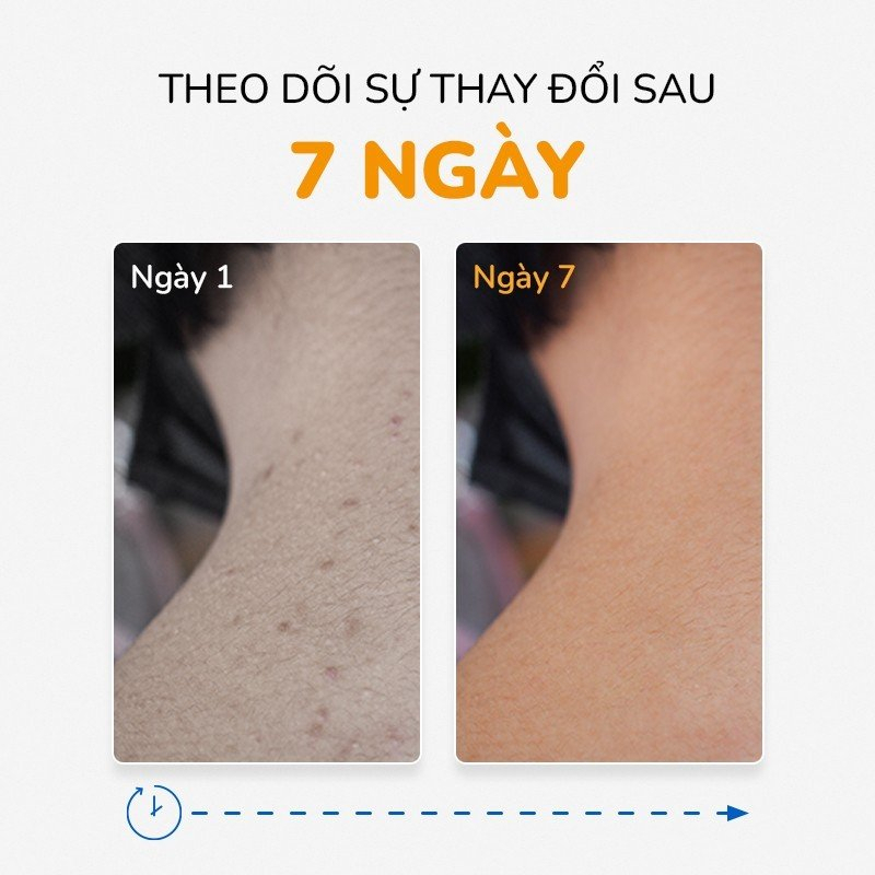 Xà Phòng Tắm Rau Má & Cúc La Mã Làm Dịu Mụn Lưng, An Toàn, Thiên Nhiên 100% Phù Hợp Với Da Body Nhạy Cảm NEOSKIN