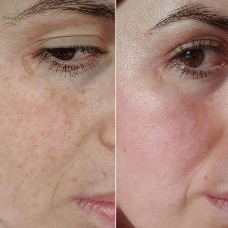 TINH CHẤT DƯỠNG SÁNG DA ASAP SUPER C COMPLEX SERUM