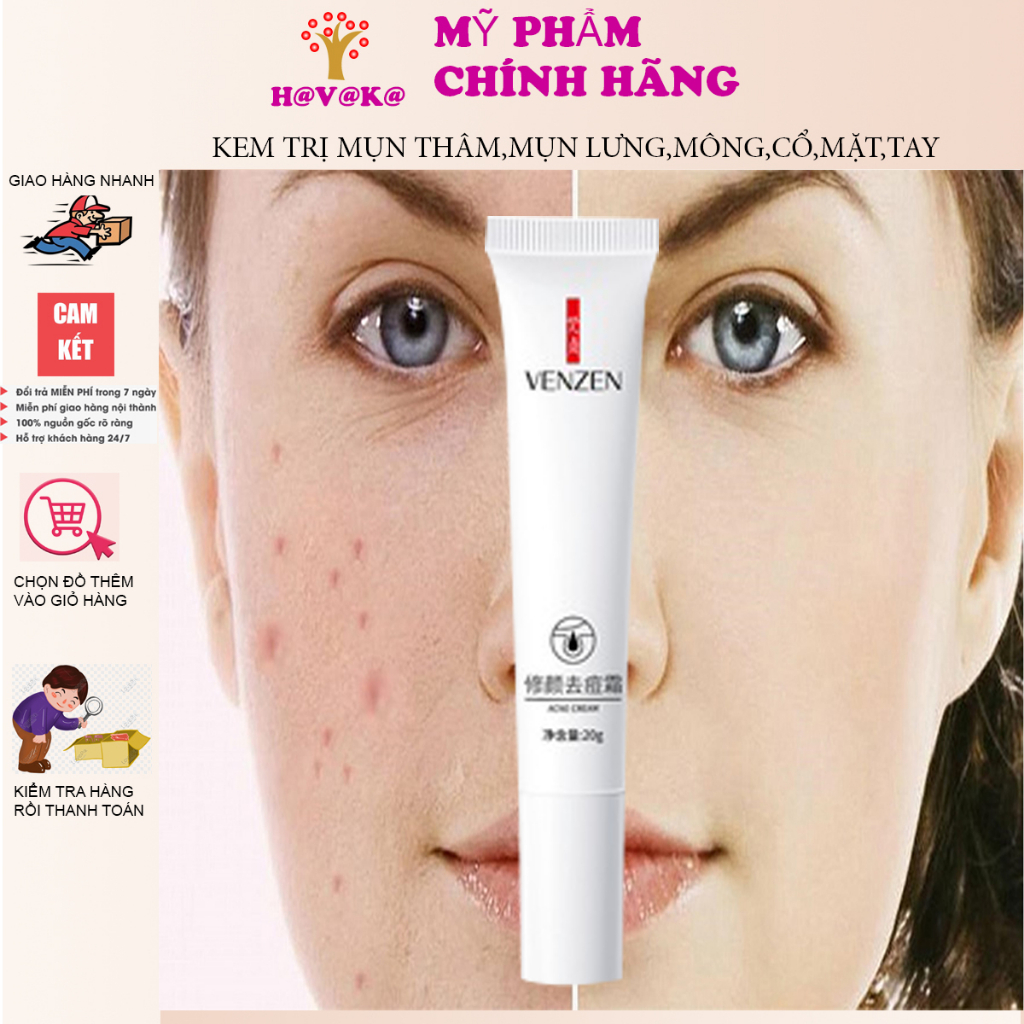 Kem giảm thâm mụn ,liền sẹo, nam, nữ,ngăn ngừa mụn,giảm dầu,mau lành vết thương VENZEN 20g
