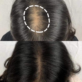 CẶP GỘI XẢ BIOTIN COLLAGEN TÍM