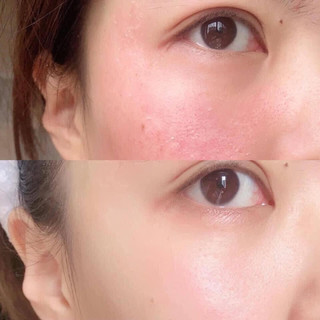 Kem dưỡng Avene Cicalfate