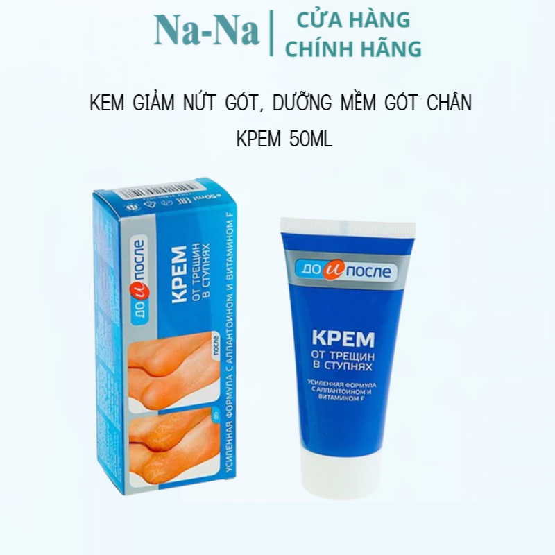 Kem dưỡng giảm nứt gót, dưỡng mềm da gót chân Kpem 50g Sản phẩm: Kem bôi giảm nứt gót chân - 50G