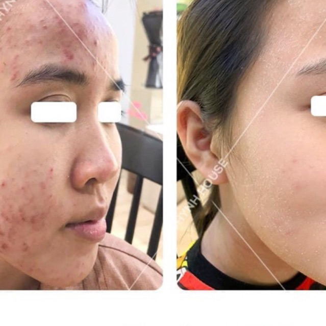 Episoo serum đường đen hạnh nhân