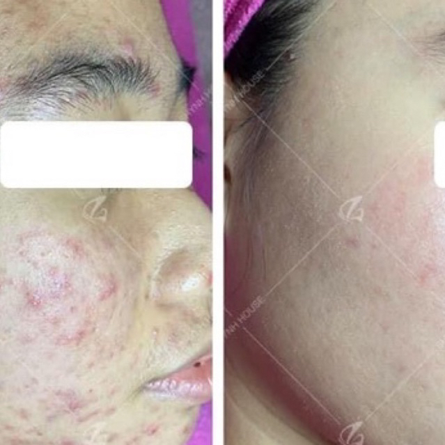 Episoo serum đường đen hạnh nhân