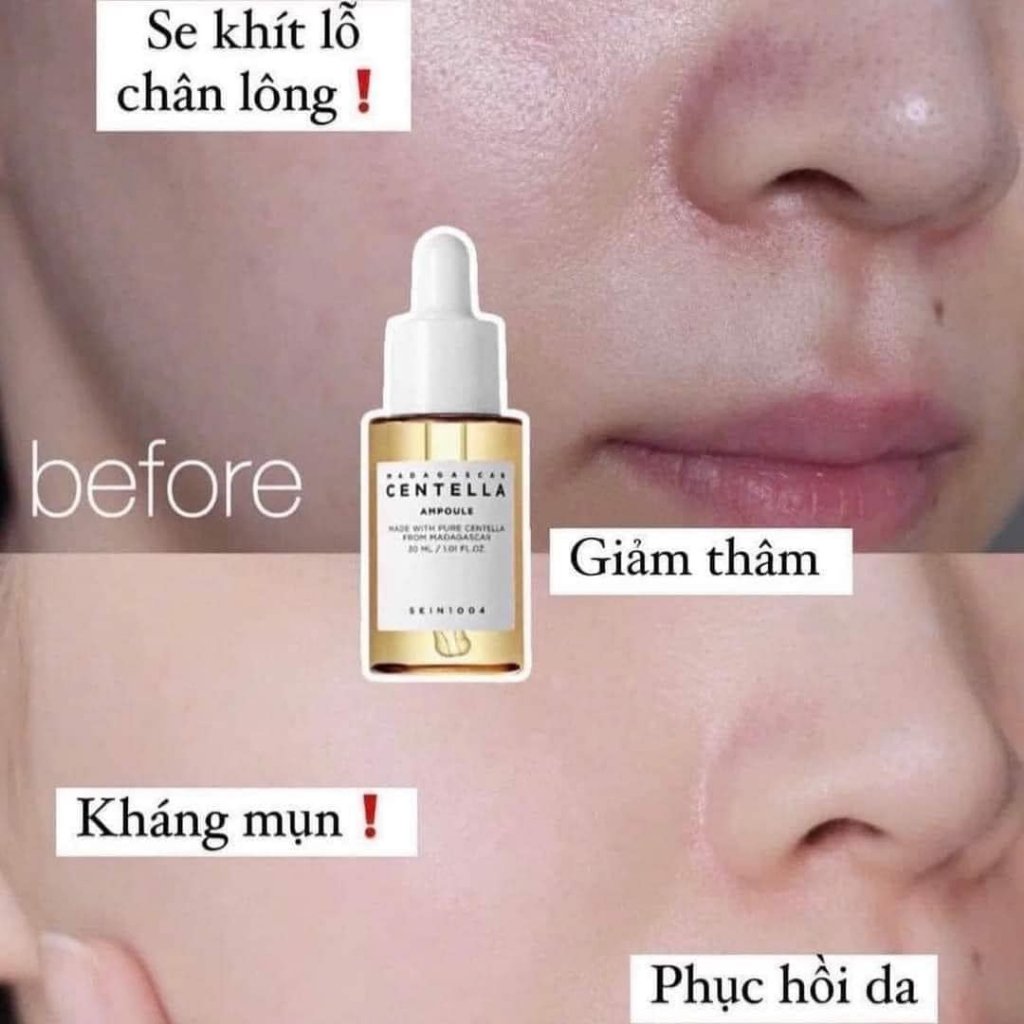 Serum Centella Ampoule