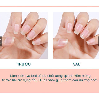 Dung Dịch Tách Móng - Nước Tháo Móng - Dầu Tháo móng úp