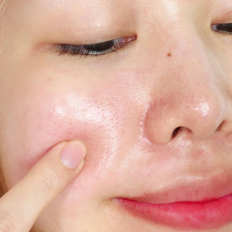 Hộp tonerpad 1OOpads MEDIHEAL