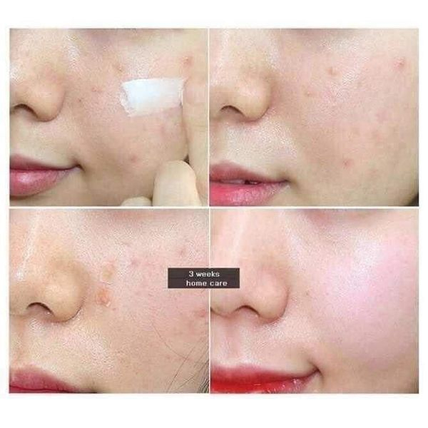 Kem chống nắng Skin 50ml