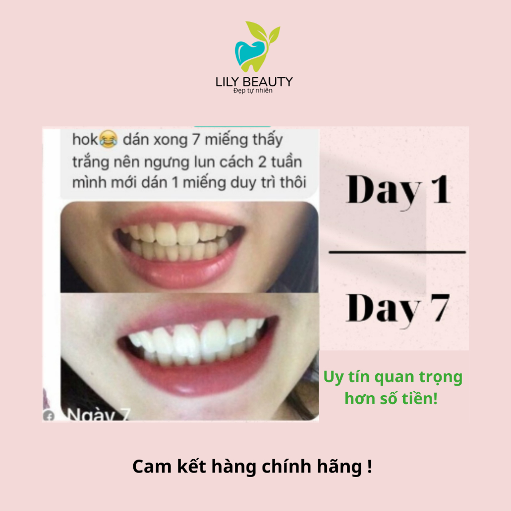 Miếng dán trắng răng Crest Professional Effects Combo 7 gói  – Giúp răng trắng sáng tự nhiên | BigBuy360 - bigbuy360.vn