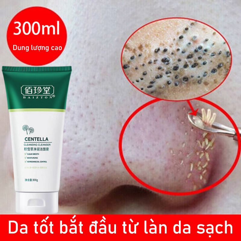 Sữa rửa mặt giảm mụn Sữa rửa mặt da sạch sâu kiềm dầu giảm mụn thâm hiệu quả
