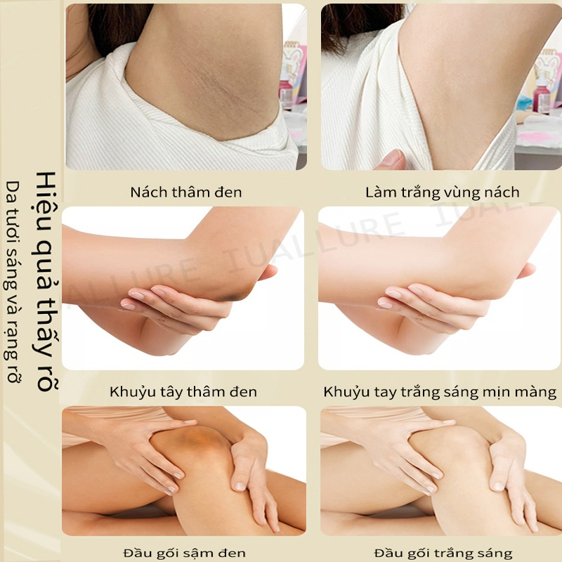 NAKIZ LIVELY BUTT - Kem Trắng Da, Giảm Thâm, Mụn, Mông, Bẹn, Nách, Lưng, Nhũ hoa, Cùi chỏ, Đầu gối freeship 🎁🎁🎁 | BigBuy360 - bigbuy360.vn