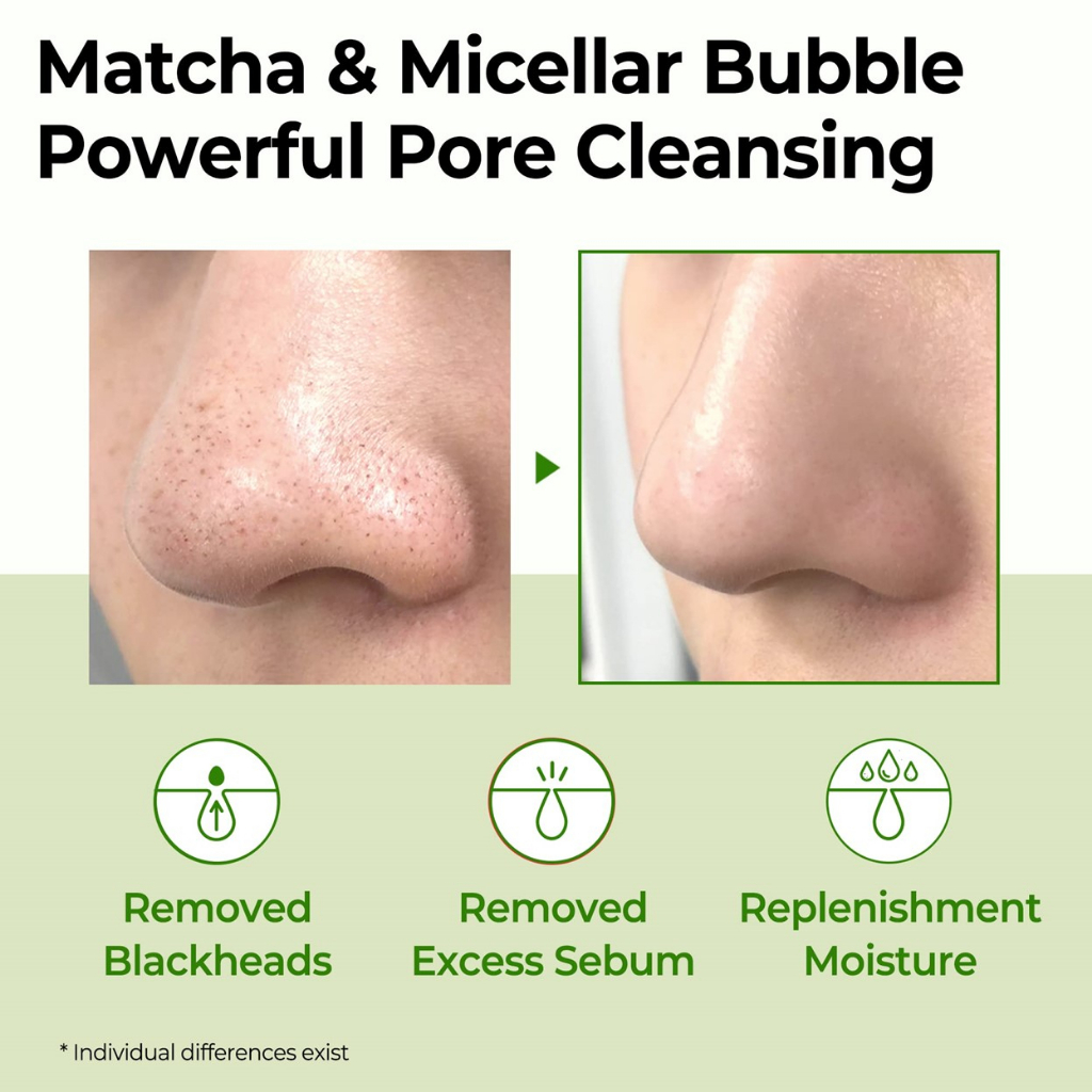 Sữa Rửa Mặt Dạng Gel Làm Sạch Sâu, Loại Bỏ Tế Bào Chết Some By Mi Super Matcha Pore Clean Cleansing Gel 100ml