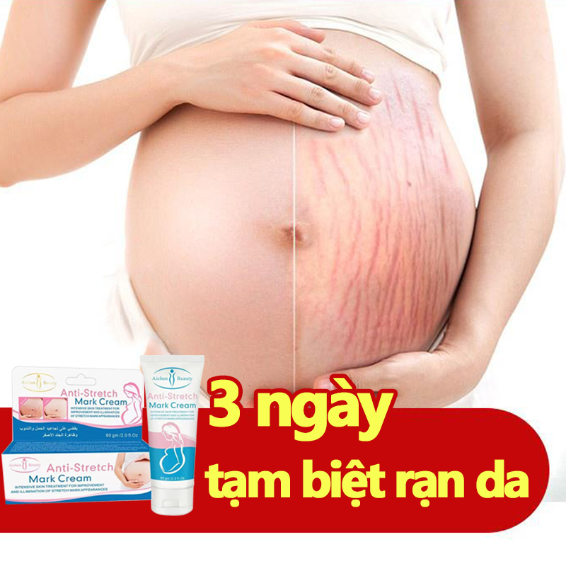 Kem chống rạn da cho bà bầu 60g Kem giảm rạn da sau sinh/Săn chắc khôi phục hư tổn/Làm trắng và sáng da