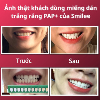 [QUÀ TẶNG Smilee Extra LIVE Hannah] 3 Miếng Dán Trắng Răng Smilee, Công nghệ PAP +