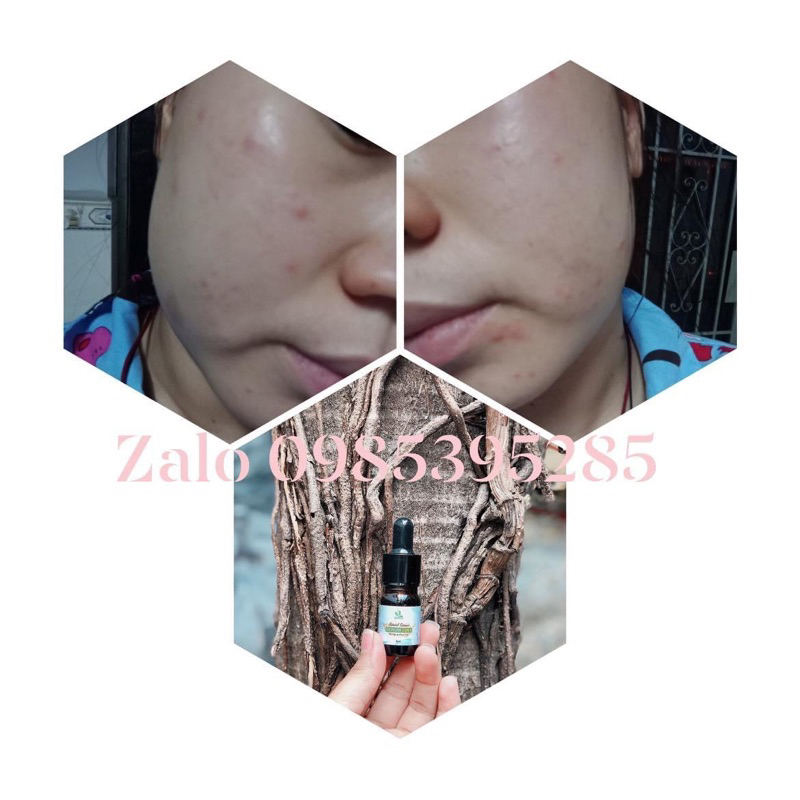 Serum đường đen 2in1 loha