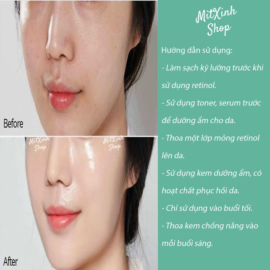 Kem Trẻ Hóa Retinol X5 Elastin Cream Của Hàn Chính Hãng