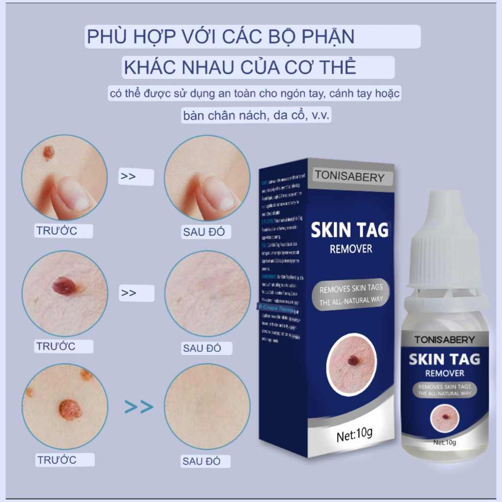 Gel tẩy mụn cóc, mụn thịt, nốt ruồi, tàng nhan...New Skin Tag Remover Wart Treatment