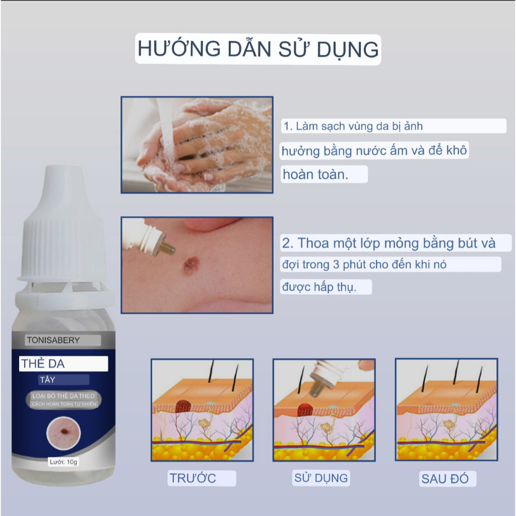 Gel tẩy mụn cóc, mụn thịt, nốt ruồi, tàng nhan...New Skin Tag Remover Wart Treatment