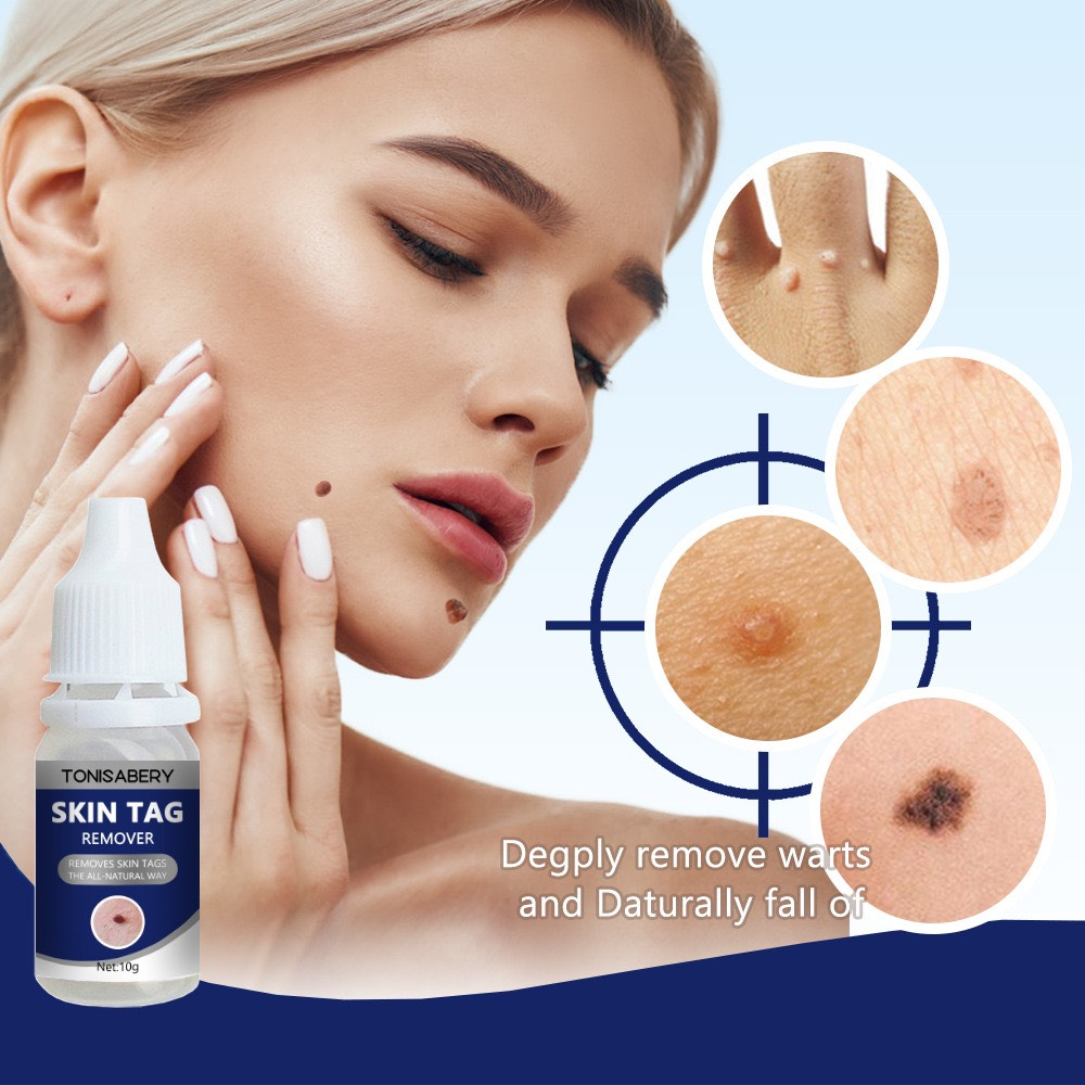 Gel tẩy mụn cóc, mụn thịt, nốt ruồi, tàng nhan...New Skin Tag Remover Wart Treatment