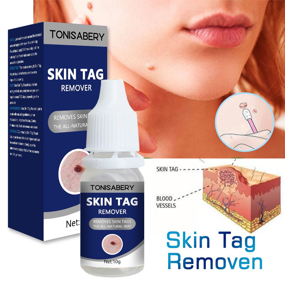 Gel tẩy mụn cóc, mụn thịt, nốt ruồi, tàng nhan...New Skin Tag Remover Wart Treatment