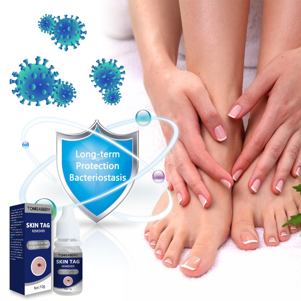 Gel tẩy mụn cóc, mụn thịt, nốt ruồi, tàng nhan...New Skin Tag Remover Wart Treatment