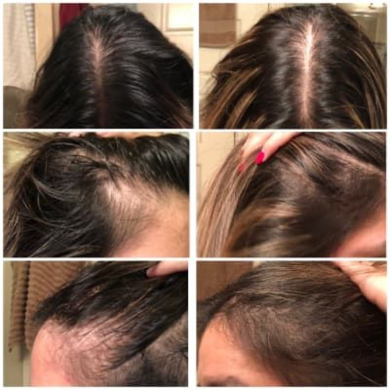 Serum mọc tóc làm dầy tócc Hair Density Serum giảm dụng kíckích thích mọc tóc mềm mượt dầy tóc chính hãng