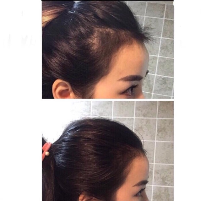Serum mọc tóc làm dầy tócc Hair Density Serum giảm dụng kíckích thích mọc tóc mềm mượt dầy tóc chính hãng
