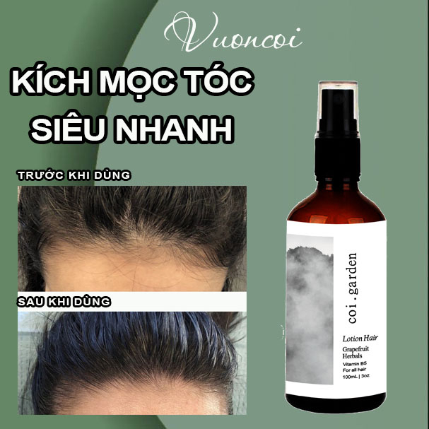 XỊT MỌC TÓC BƯỞI THẢO MỘC - XỊT MỌC TÓC NHANH TỪ THIÊN NHIÊN BƯỞI THẢO MỘC