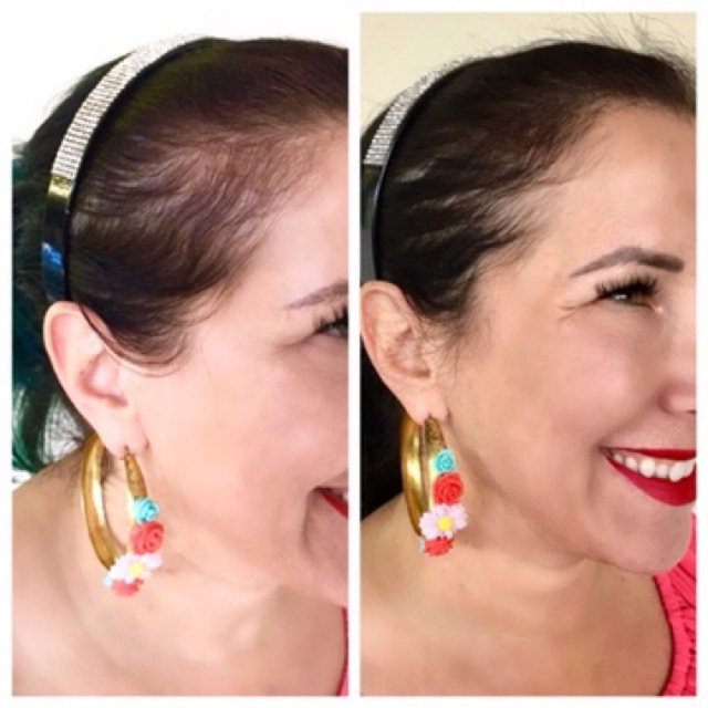 Serum mọc tóc làm dầy tócc Hair Density Serum giảm dụng kíckích thích mọc tóc mềm mượt dầy tóc chính hãng