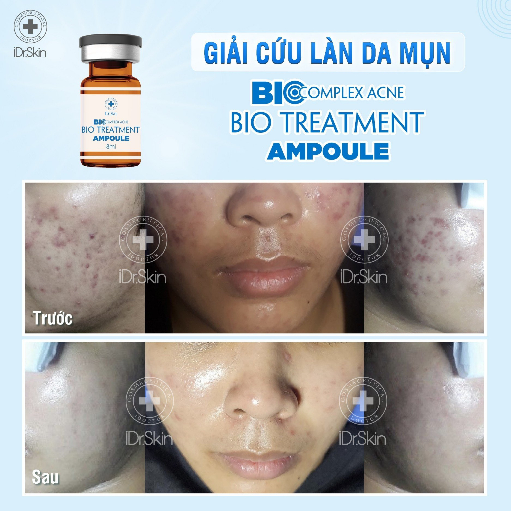 Tế bào gốc mụn IDr Skin_ Bio Complex Acne Treatment Ampoule