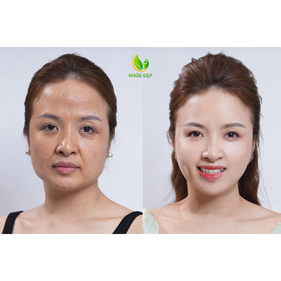 Serum trẻ hóa làn da UCUC, serum chống lão hóa, giảm nếp nhăn, mờ nám sạm, dưỡng da trắng sáng