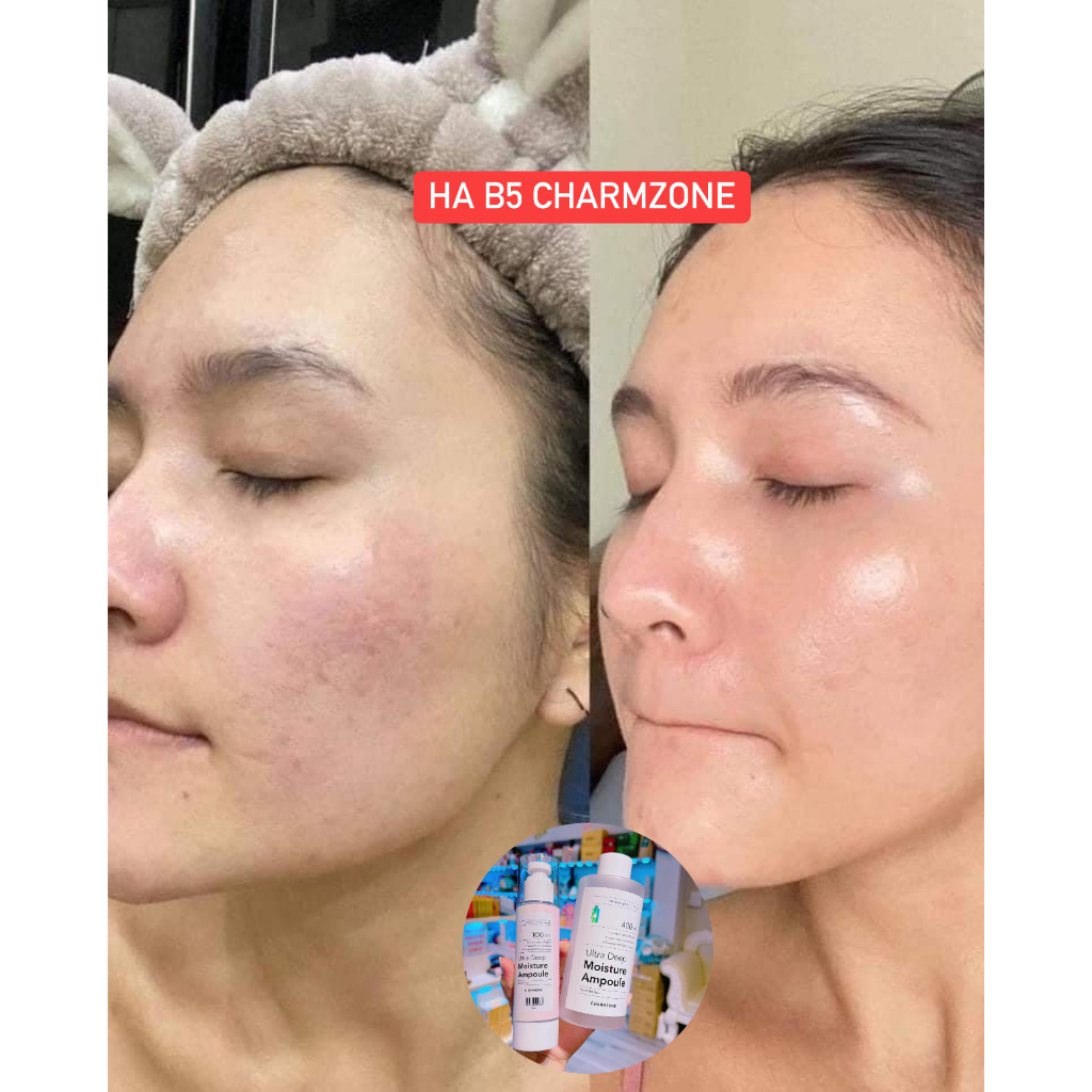 Serum phục hồi HA B5 Charmzone Ultra Deep Moisture Ampoule 400ml