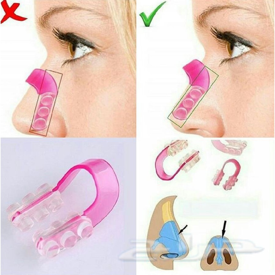 Kẹp Định Hình Nâng Cao Mũi Tiện Dụng