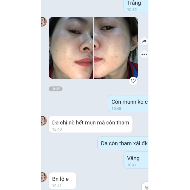 SERUM CARAMEL ESSENCE 1ST NHẬT BẢN