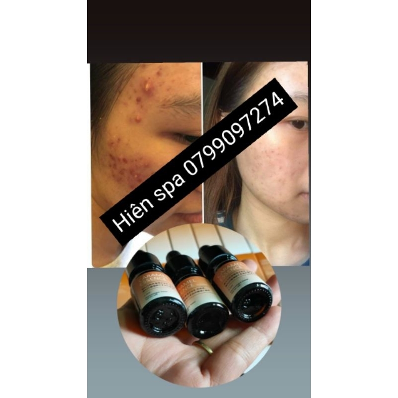 SERUM CARAMEL ESSENCE 1ST NHẬT BẢN