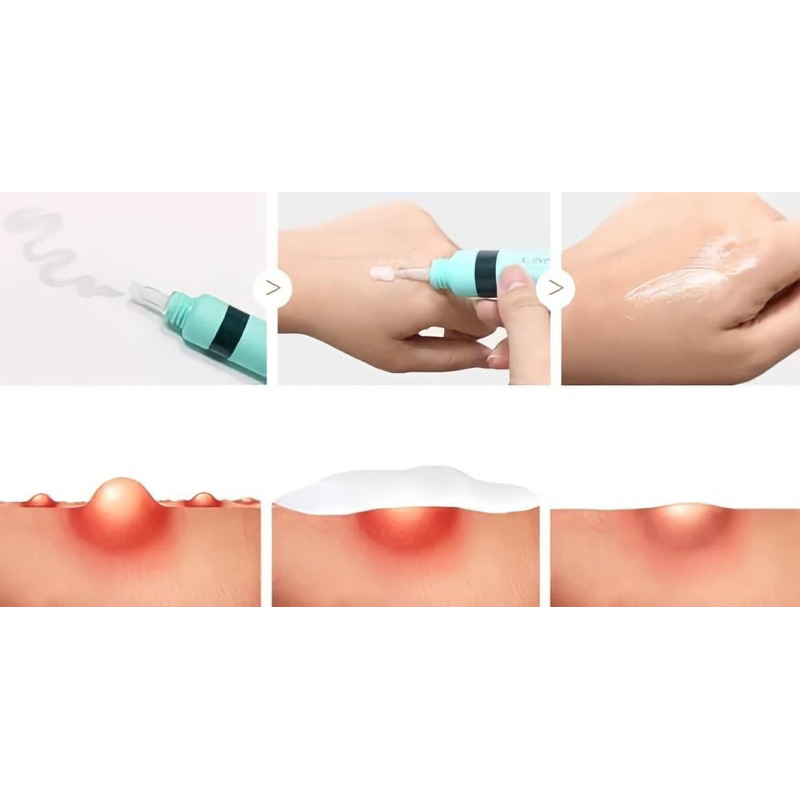 Tinh chất rau má  tr! mụn Dermaphilia Control Solution Serum