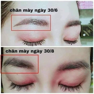 Kích mọc mi,chân mày thái lan