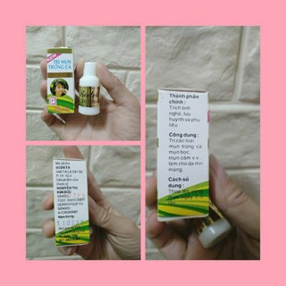 Kem mụn acne cream 10g bodeta chính hãng 100%