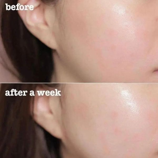 Nước Thần Estee Lauder Micro Essence Skin Activating Treatment Lotion 150ml/200ml