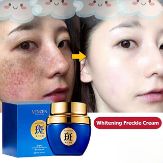 Kem dưỡng trắng kem dưỡng ẩm mặt tàn nhang chống lão hóa bỏ mụn thâm nám da nhạy cảm làm mờ tàn nhang dưỡng trắng da mặt