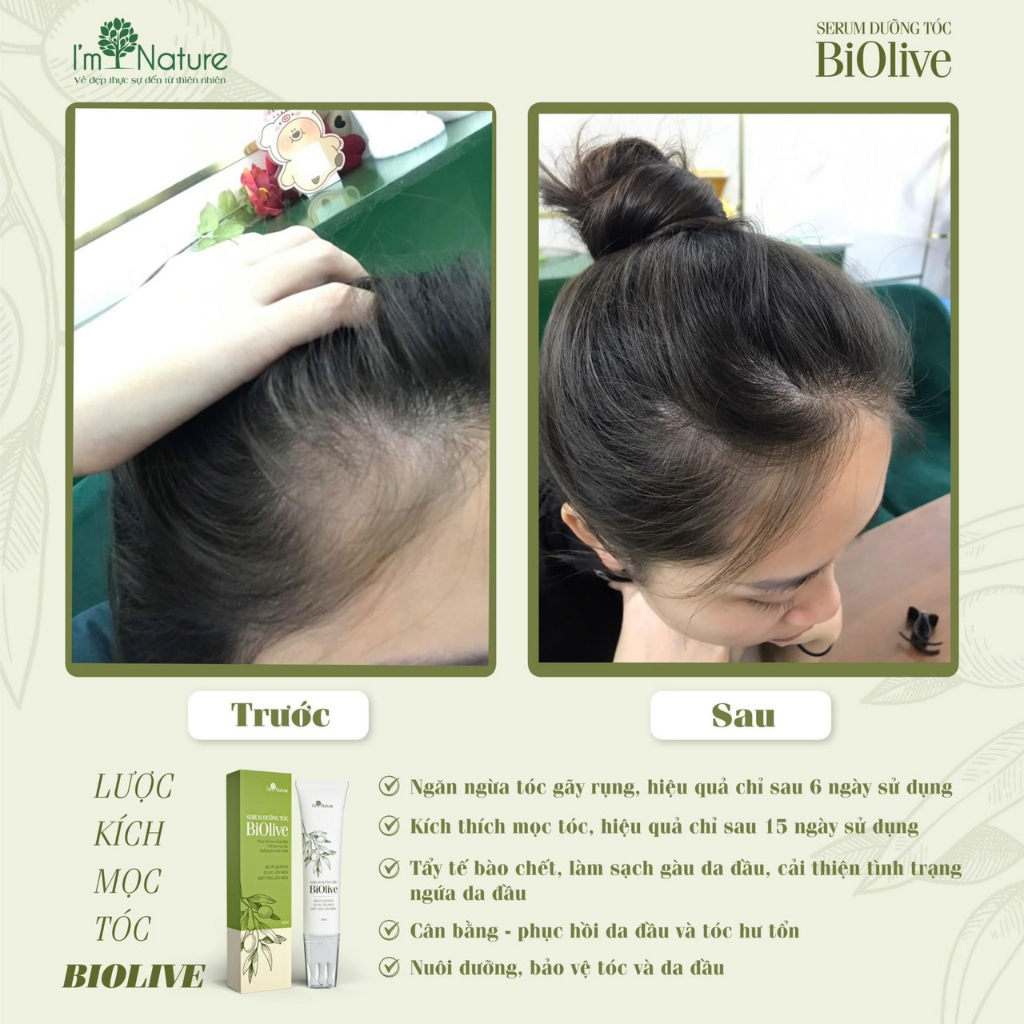 Serum Dưỡng Tóc Biolive I'm Nature Đầu Bi Chải Massage 60ml Tặng Kèm Nước Hoa