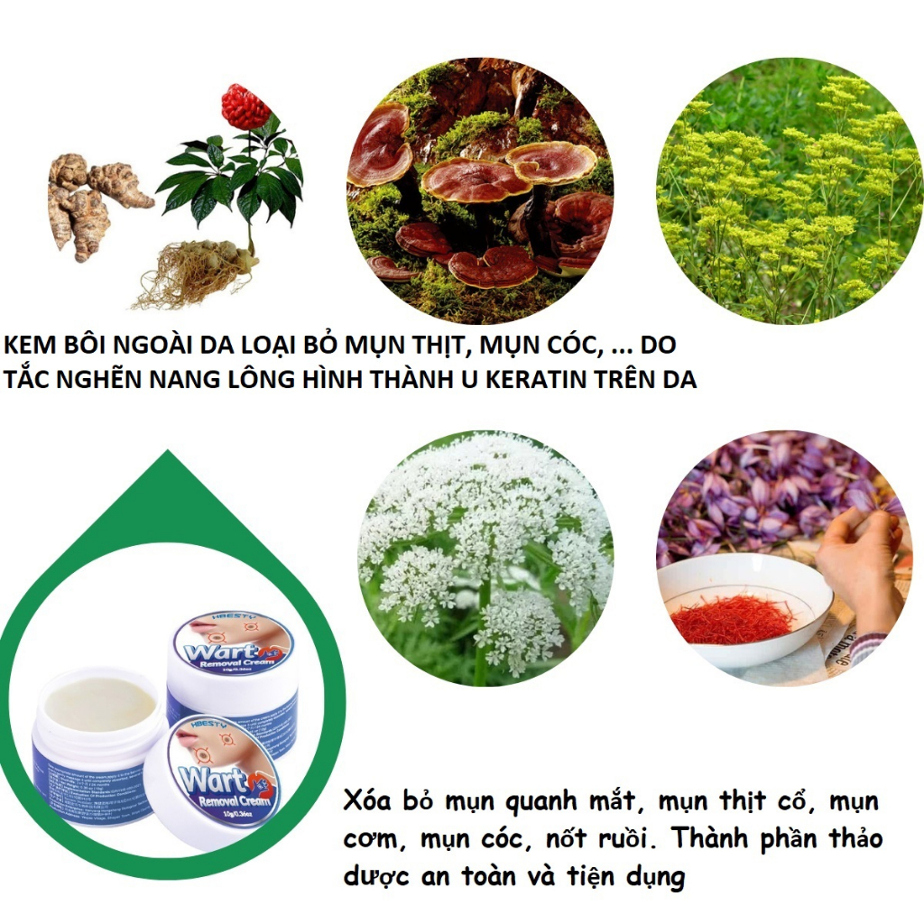 Kem xóa mụn thịt, mụn cơm lâu năm và cứng đầu, giúp dưỡng da, se khít lỗ chân lông_HBESTY_HU